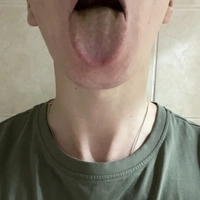 Soska